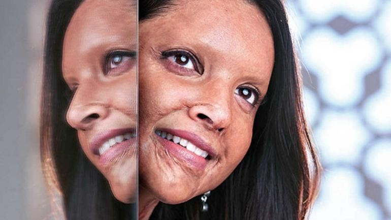 Deepika Padukone film Chhapaak first look. Deepika Padukone film Chhapaak first look