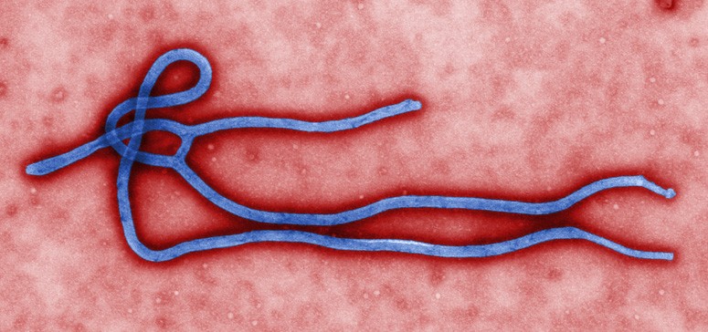 A new Ebola outbreak has been declared in the Democratic Republic of Congo Deadly viral diseases