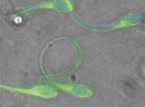 an-electron-microscope-image-shows-sperm-from-human-donors