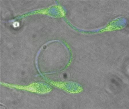 An electron microscope image shows sperm from human donors