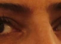 new-layer-in-human-cornea-discovered