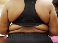 Obesity