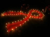 HIV