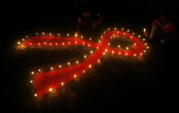 HIV
