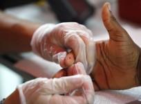 a-medical-technician-draws-a-blood-sample-from-a-patient