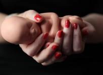 ant-acne-drug-forces-woman-to-abort-first-child