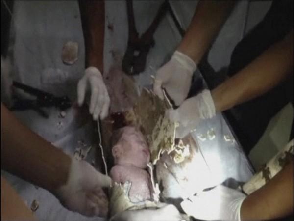 Firefighters and doctors rescue an abandoned newborn baby boy by cutting away a sewage pipe piece by piece, in this still image taken from video, in Jinhua city, Zhejiang province May 25, 2013 (Reuters) Chinese newborn baby
