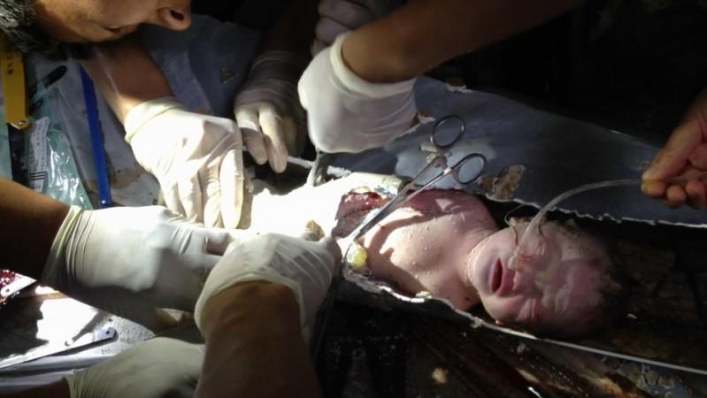 Firefighters and doctors rescue an abandoned newborn baby boy by cutting away a sewage pipe piece by piece, in this still image taken from video, in Jinhua city, Zhejiang province May 25, 2013 (Reuters) Chinese Newborn baby
