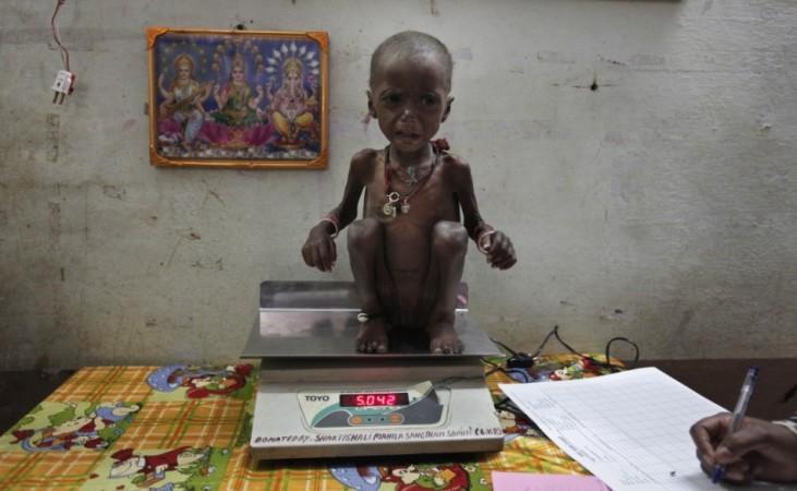 Malnourished child