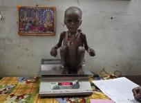 malnourished-child