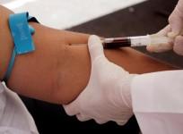 blood-test