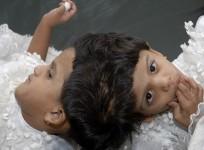 Vani (L) and Veena
