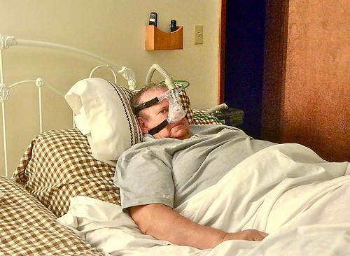 CPAP, sleep apnea