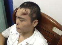 xiaolian-with-his-new-nose