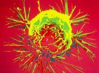 breast-cancer-cell