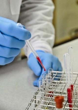 Blood Sample