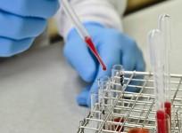 Blood Sample