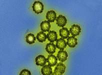 H1N1 Influenza Virus Particles