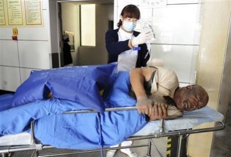 Injured man being treated at a hospital after the oil pipeline in China exploded Injured man being treated at a hospital after the oil pipeline in China exploded
