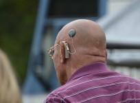 hearing-aid