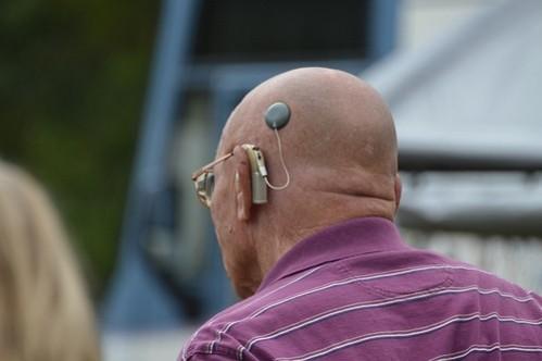 Hearing loss affects over 360 million people around the world Hearing aid
