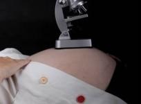 IVF pregnancy