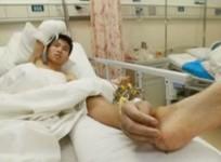 chinese-man-with-hand-attached-to-ankle
