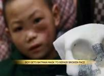 chinese-boy-with-batman-style-titanium-mask-inside-his-face