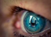 Contact lens