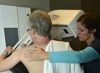 Mammography