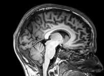brain scan
