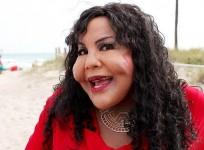 plastic-surgery-earns-woman-the-nickname-039cement-face