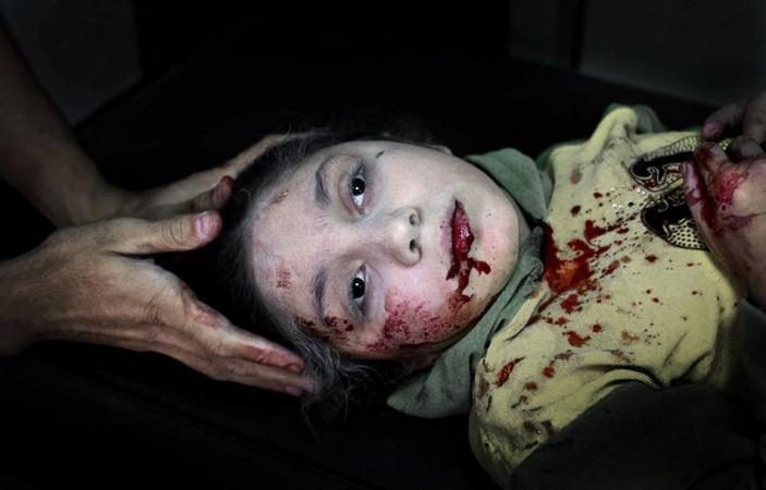 This Picture of 11-Year-Old Syrian Child Dania Injured by Shrapnel Wins Award (Credit: Niclas Hammarström/Kontinent/UNICEF Press Release)