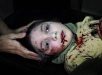 this-picture-of-11-year-old-syrian-child-dania-injured-by-shrapnel-wins-award-credit-niclas-hammarstrm-kontinent-unicef-press-release