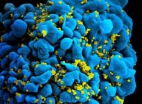 hiv