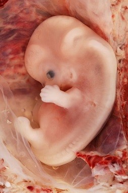 New Technology Can Help Prospective Parents Meet Their Baby Even before it's Conceived (Wiki Commons/Ed Uthman)
