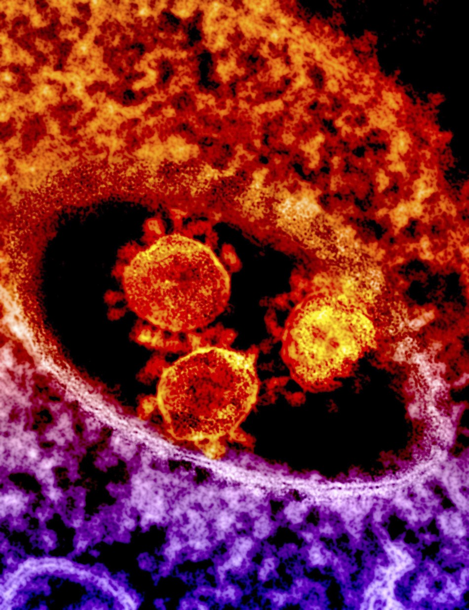 Image Result For Origin Of The Coronavirus