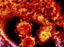 mers-or-middle-east-respiratory-syndrome-has-now-spread-to-us-here-are-five-things-to-know-including-its-origin-history-symptoms-and-treatment-photo-reuters