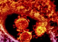 us-announces-first-case-of-the-mers-virus