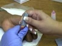 fears-south-africas-treatment-success-could-breed-complacency