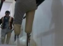 new-limbs-aid-syrians-in-long-walk-back-from-war