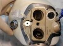 confidence-remains-after-artificial-heart-patient-dies