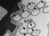 Cross-section of fossilized ostracod sperm. The nuclei in each sperm (dark spot) are indicated by arrows (R. Matzke-Karasz)
