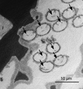 Cross-section of fossilized ostracod sperm. The nuclei in each sperm (dark spot) are indicated by arrows (R. Matzke-Karasz)