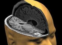brain