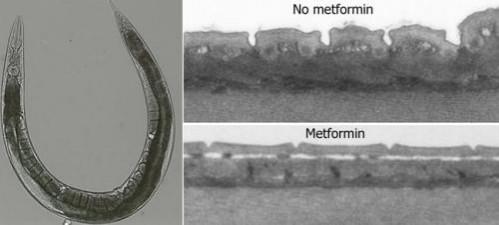 Roundworms treated with metformin showed very limited size loss and no wrinkling. Roundworms