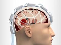 Strokefinder