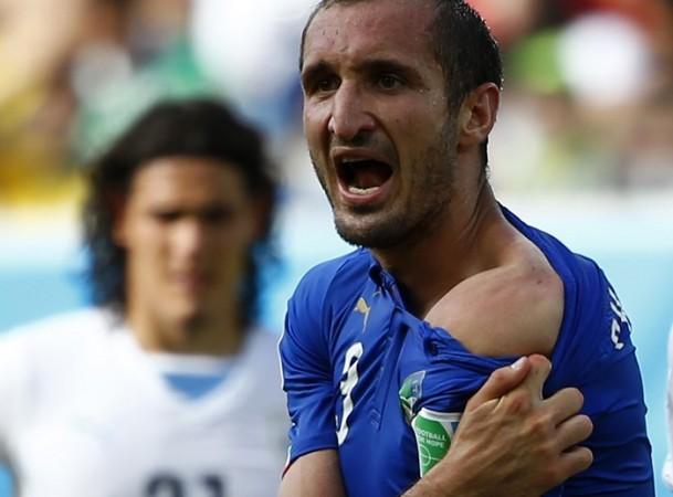 Italy defender Giorgio Chiellini shows his shoulder after claiming he was bitten by Uruguay forward Luis Suarez, 24 June Giorgio Chiellini Italy