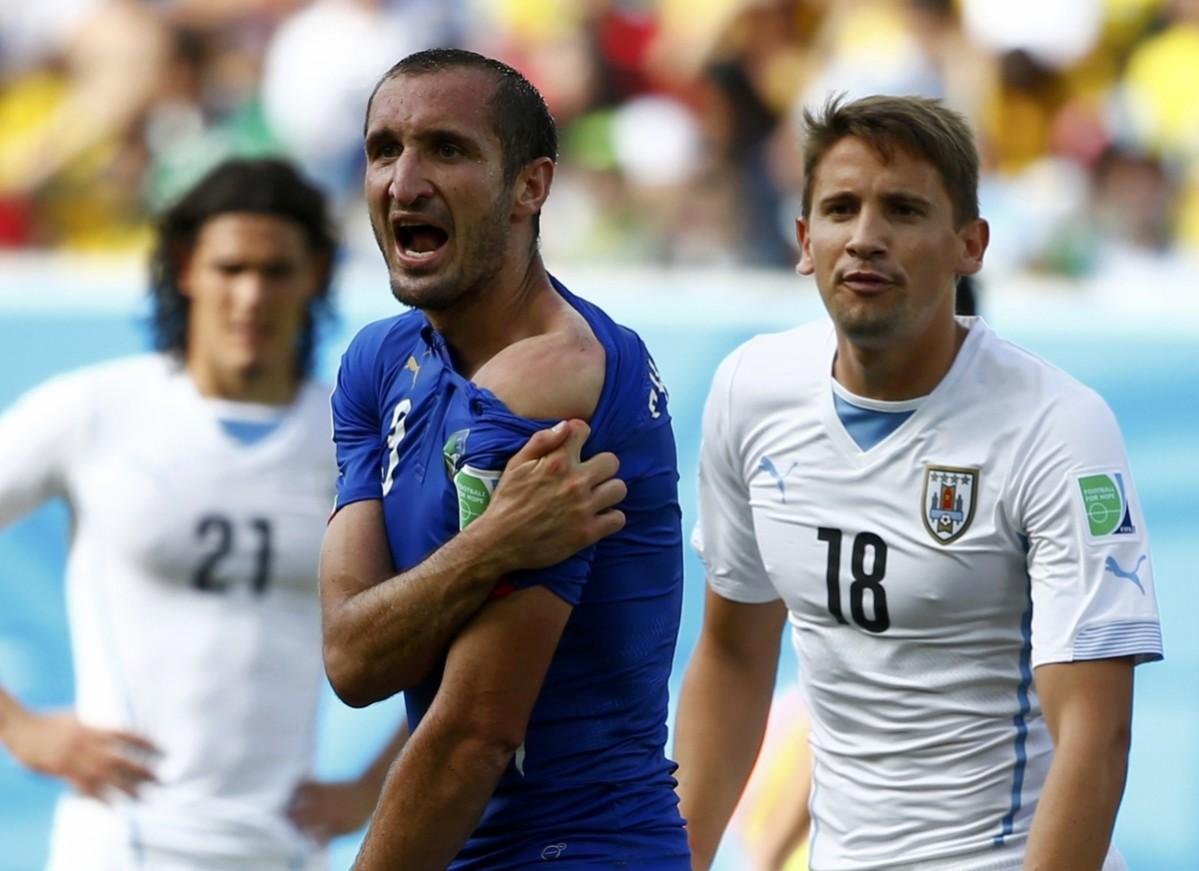 Italy's Giorgio Chiellini shows his shoulder, claiming he was bitten by Uruguay's Luis Suarez, during their 2014 World Cup Group D match at the Dunas arena in Natal Italy vs Uruguay
