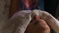burn-patient-burn-medical-inferno-in-china